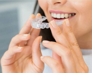 Aligners